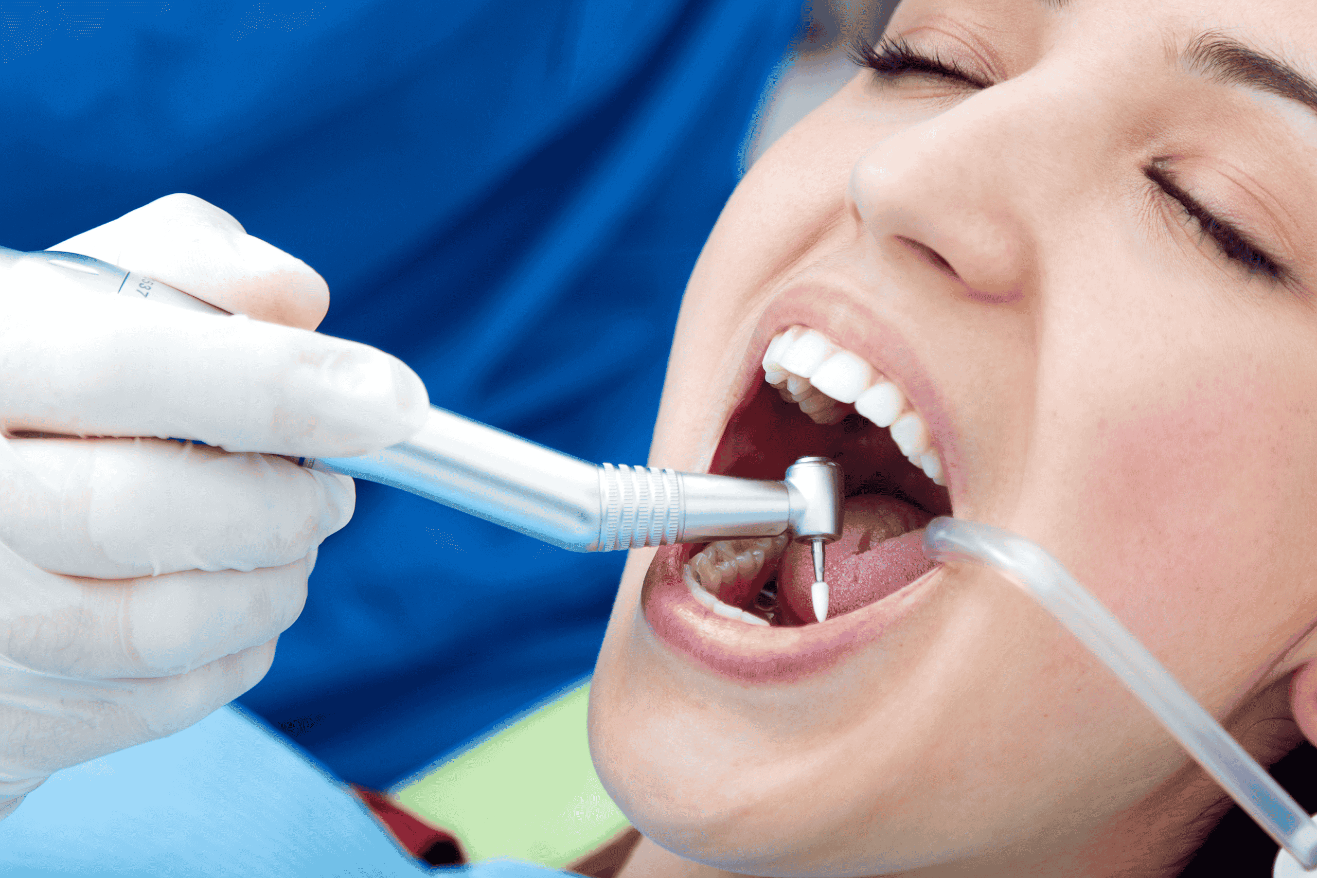 Dental-fillings-1